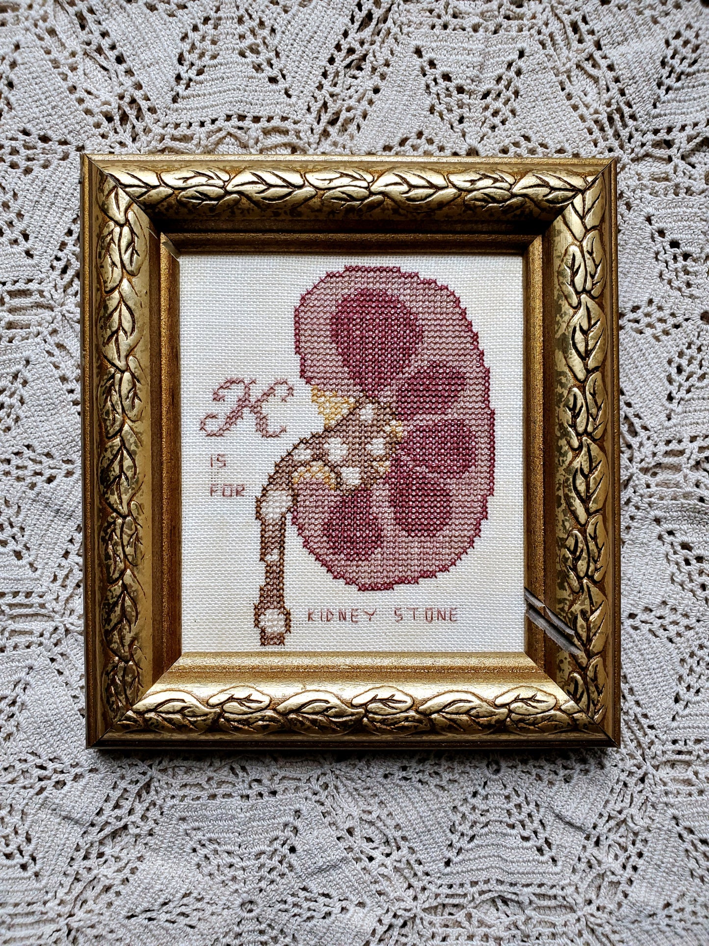 K is for Kidney Stone by Heartstring Samplery PDF Cross Stitch Chart 100% CHARITY