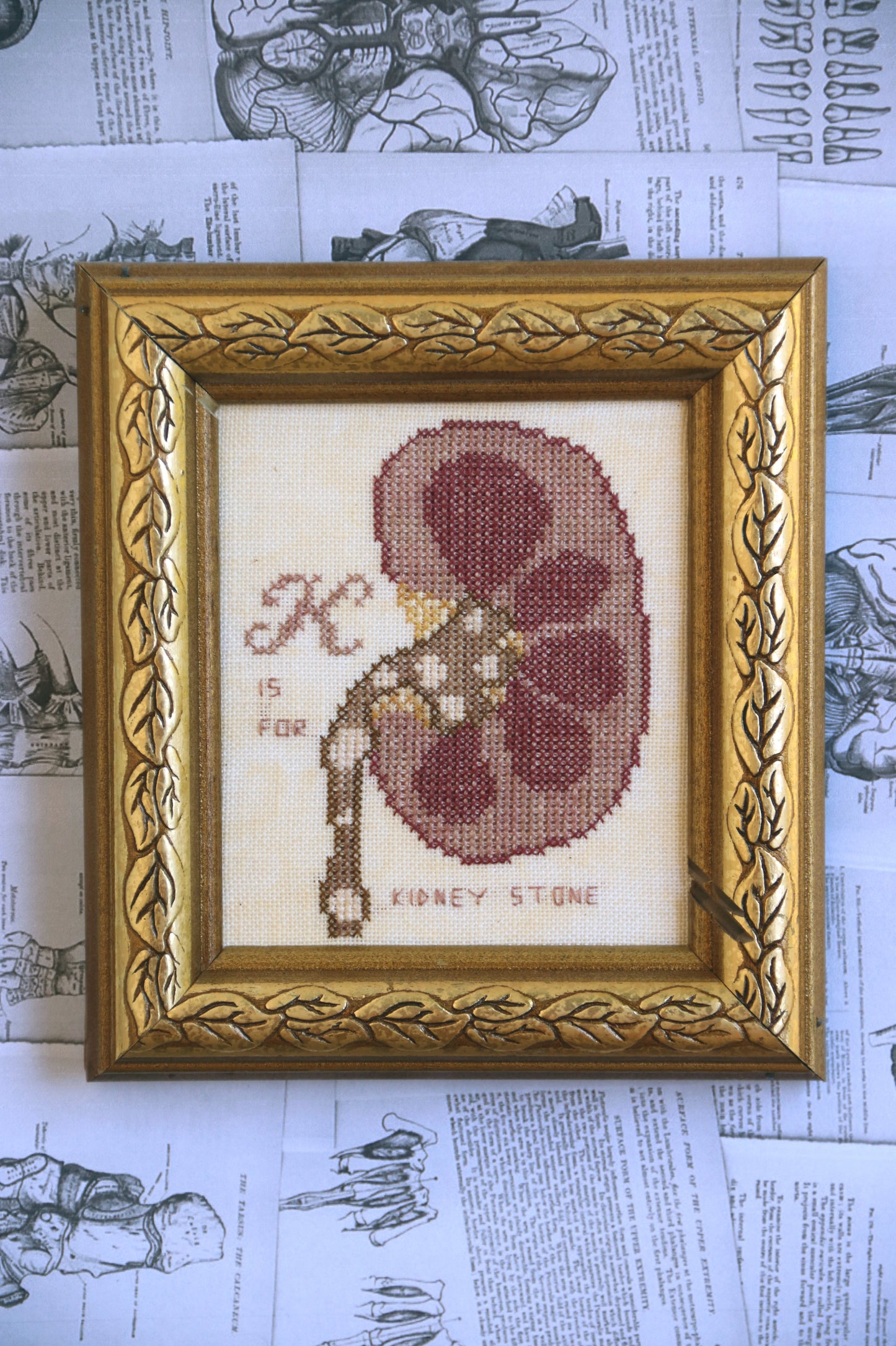 K is for Kidney Stone by Heartstring Samplery PDF Cross Stitch Chart 100% CHARITY
